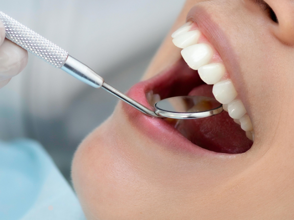 Get Prepared for Your Consultation Teeth Grinding Treatment