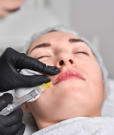 What Are Dermal Fillers 530